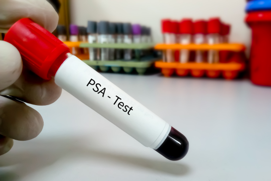 PSA blood test