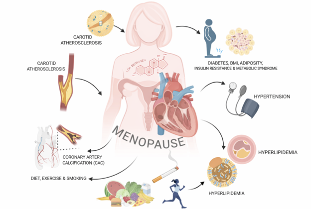 Diagram of Menopause and Heart Health
