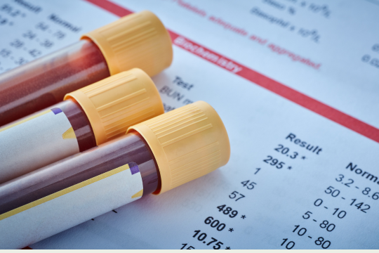 blood test vials on result paper